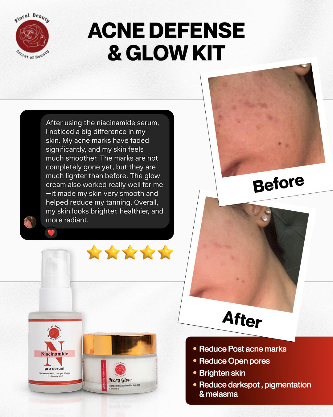 Acne defense & glow kit